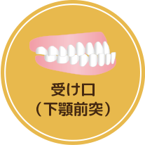 さまざまな歯並び不正咬合の種類