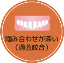 さまざまな歯並び不正咬合の種類