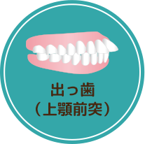 さまざまな歯並び不正咬合の種類