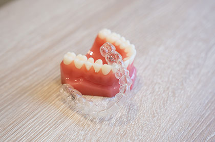 透明で目立たないマウスピース型カスタムメイド矯正歯科装置は大人の歯列矯正にぴったり