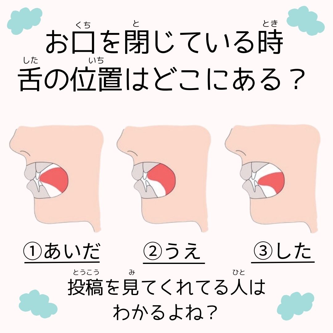 舌の正しい位置はどこ？