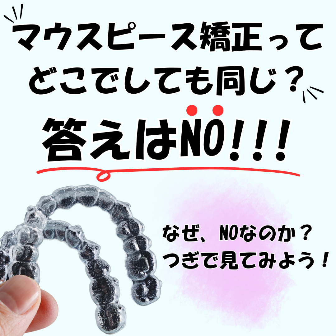 マウスピース矯正について