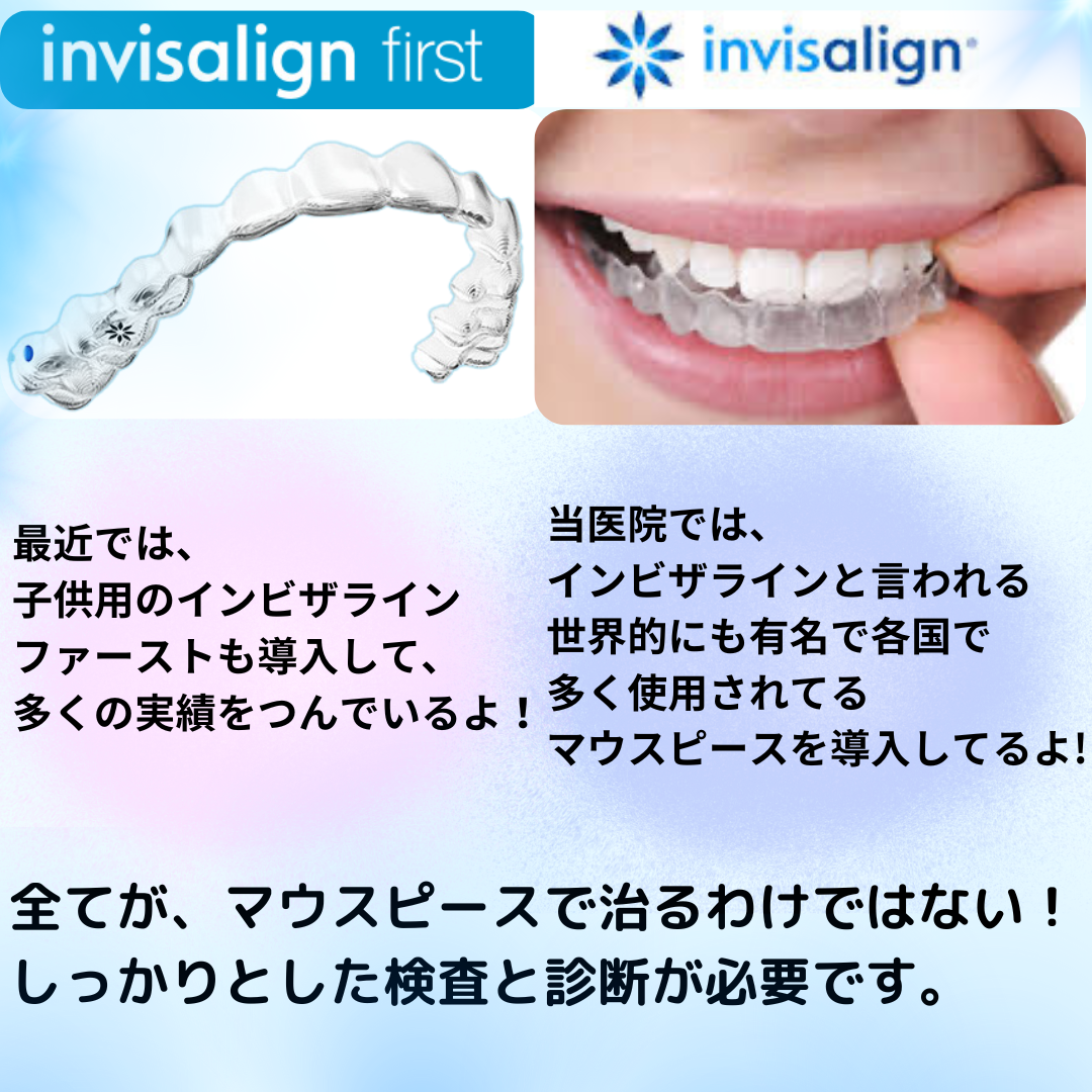 マウスピース矯正について