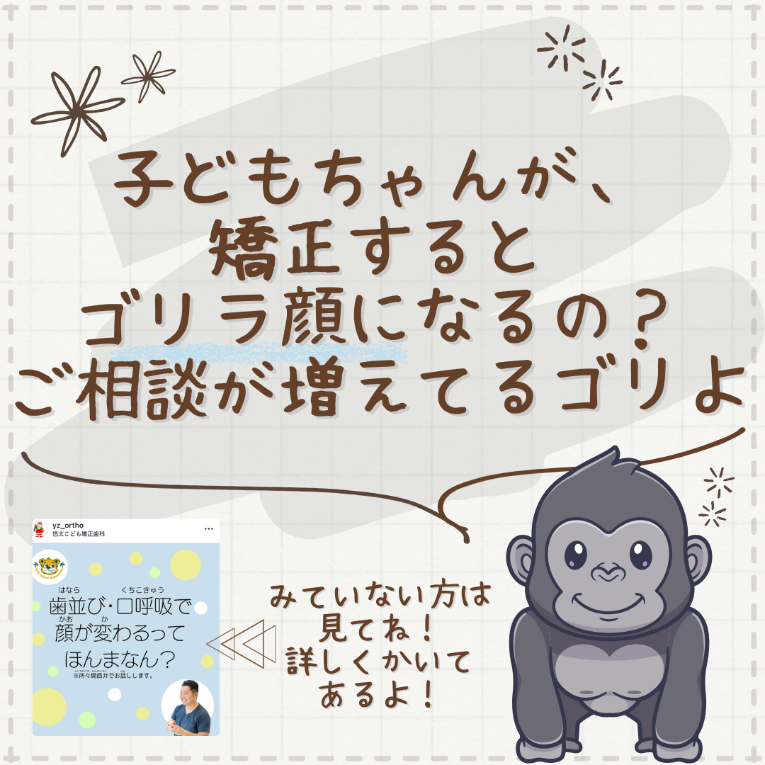 ゴリラ顔になる？と相談が増えています。